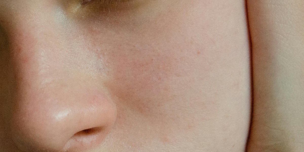 DIY Lip Plumper Recipes: Natural Alternatives for Fuller Lips