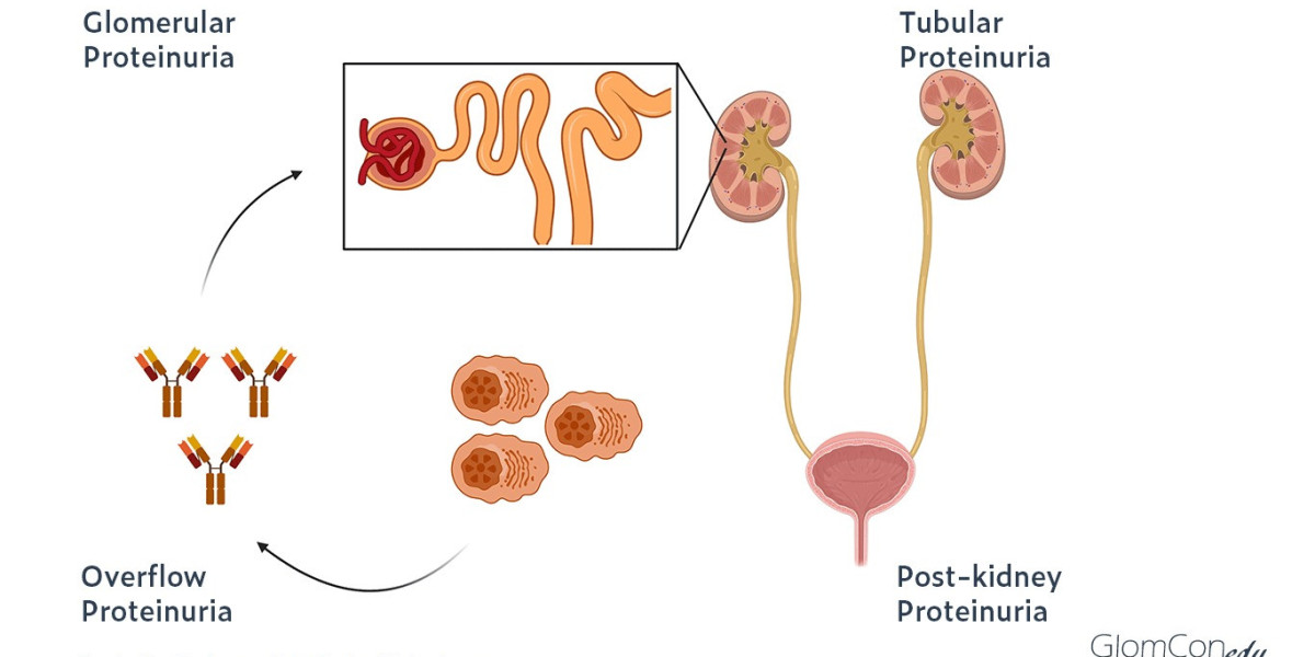 Proteinuria Market Outlook, Industry Size, Growth Factors, Investment Opportunity 2024-2034