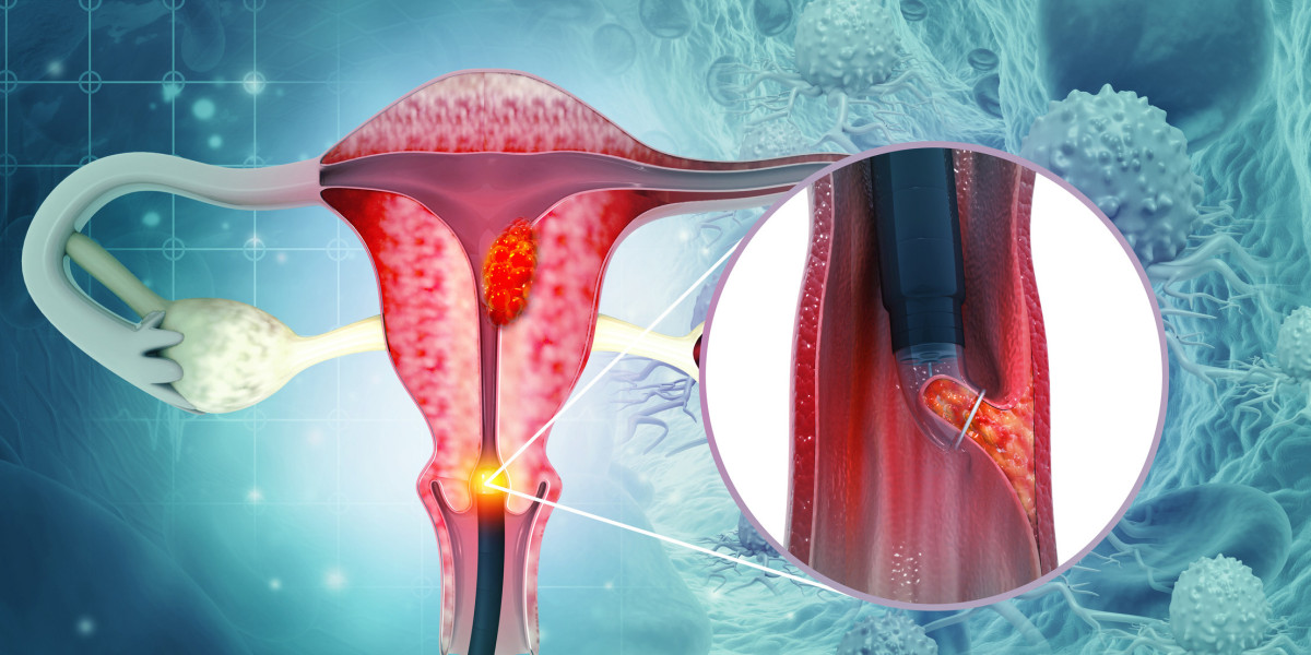 Market Research Overview: Cervical Cancer Diagnostic Testing Market