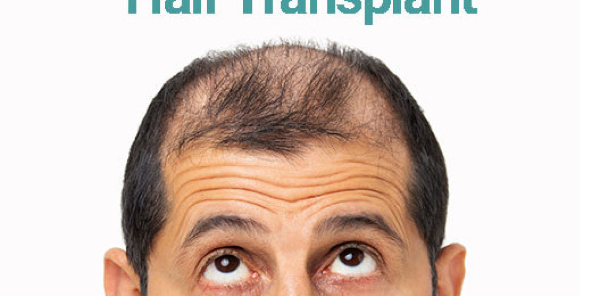 Hair Transplant Market Trends Show Rising Adoption of Robotic and Laser-Assisted Techniques
