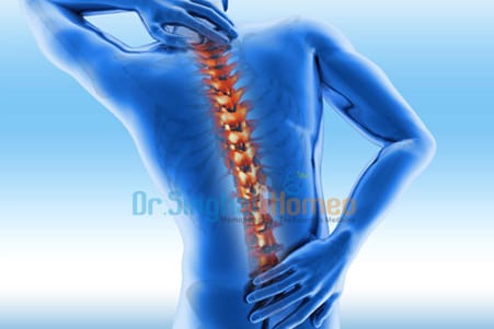 Find Safest Ankylosing Spondylitis Homeopathy Treatment