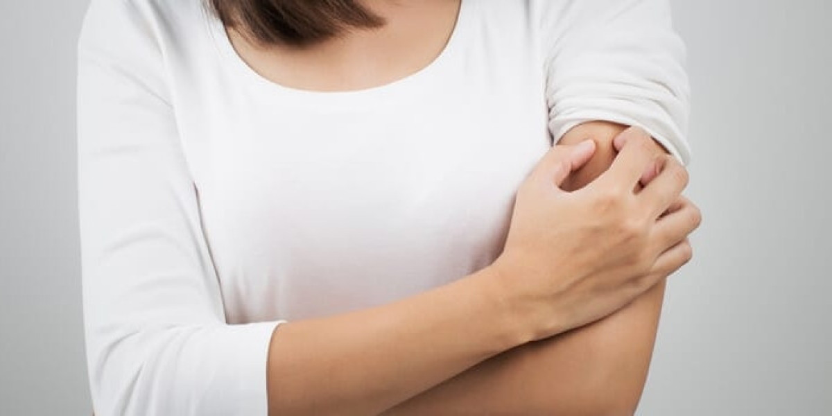 Unlocking the Potential of Singapore's Dermatological Therapeutics Sector