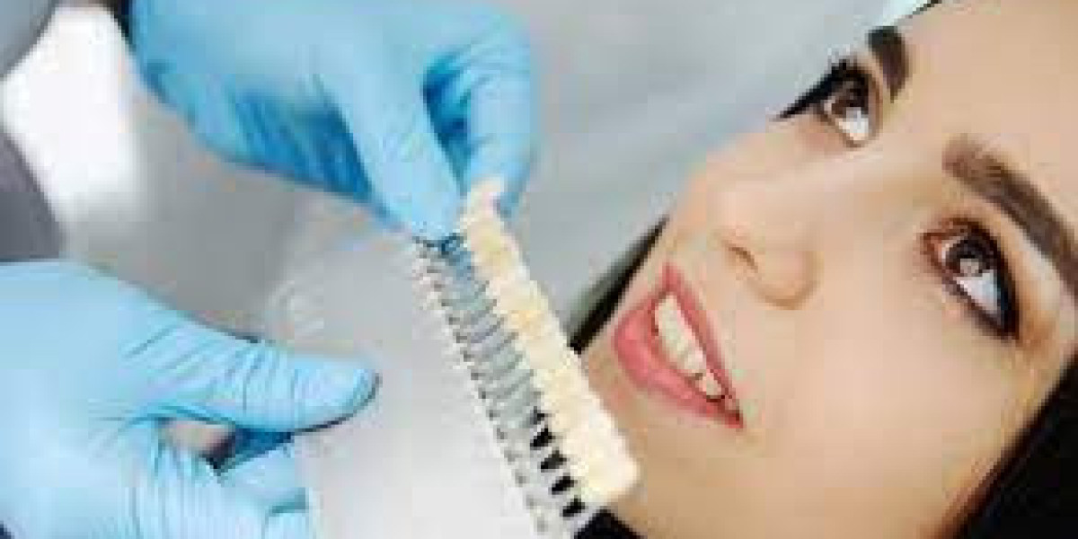 Common Myths About Cosmetic Dentistry in San Antonio, TX