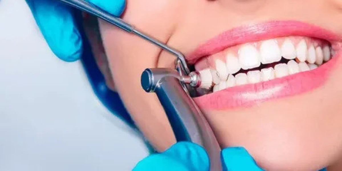 Teeth Cleaning and Dental Implants in Marietta, GA: Your Path to a Healthier Smile with Benich Dental