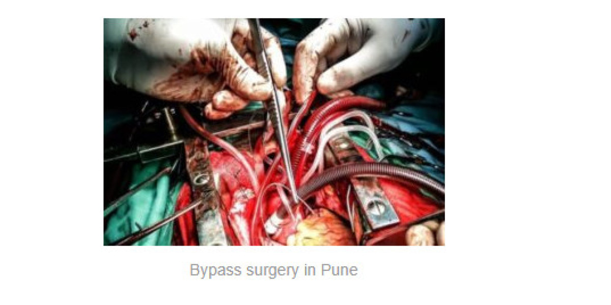 Heart surgery: Looking for reliable heart surgery? Dr. Ashish Dolas offers expert heart care with 1500 successful surger