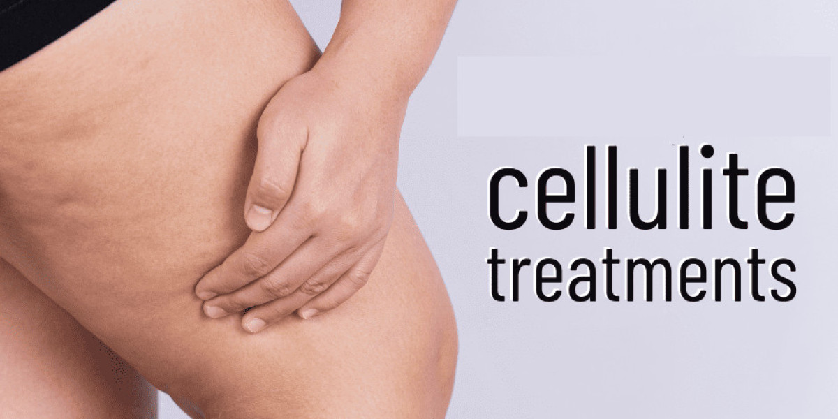 Rising Disposable Income Fuels Consumer Spending, Enhancing Cellulite Treatment Market Share