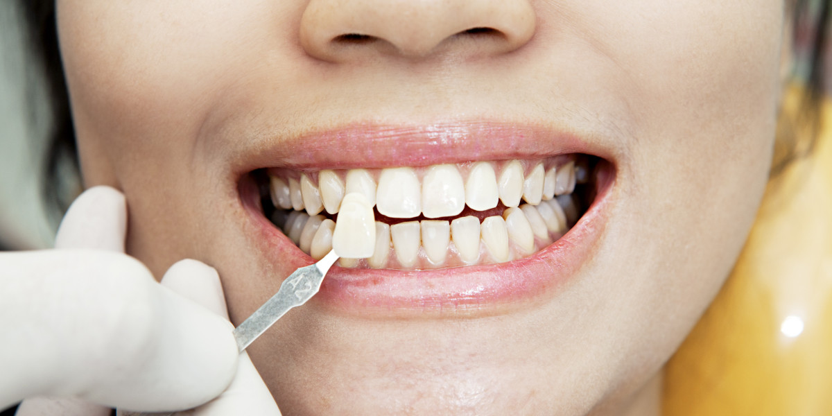 Top Reasons to Choose Restorative Dentistry for Tooth Repair