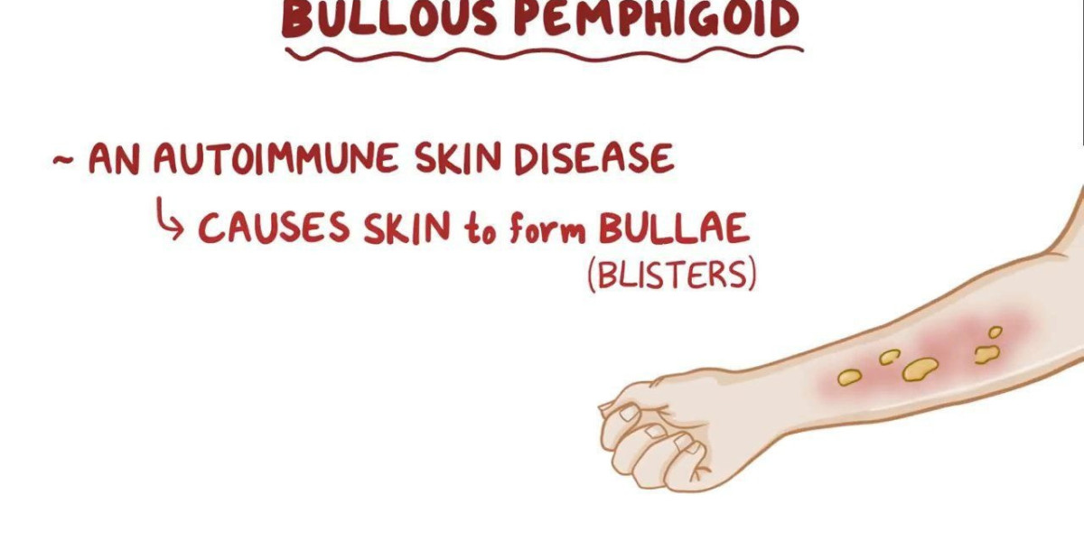 Bullous Pemphigoid Market Growth Analysis, Trends, Report 2024-34