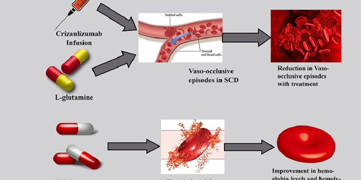 Sickle Cell Disease Treatment Market to Develop New Growth and Opportunities Analysis Story