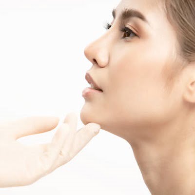 Cheek Augmentation Islamabad, Rawalpindi & Pakistan - Cheek Implant