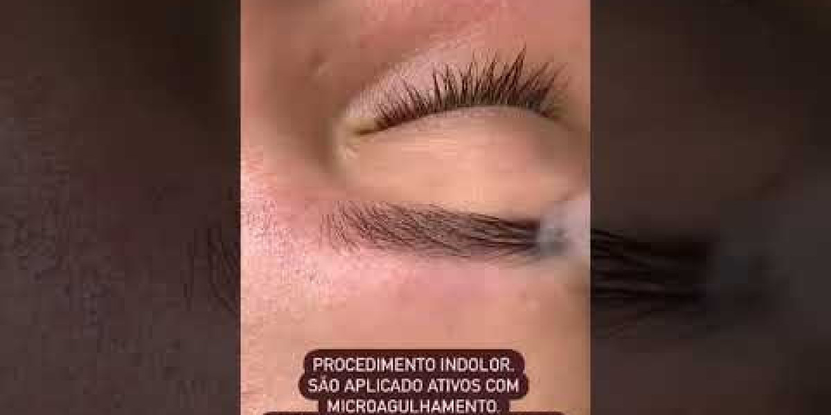 Transforme sua Carreira com o Curso de LiftLaser: O Segredo da Estética Corporal de Sucesso