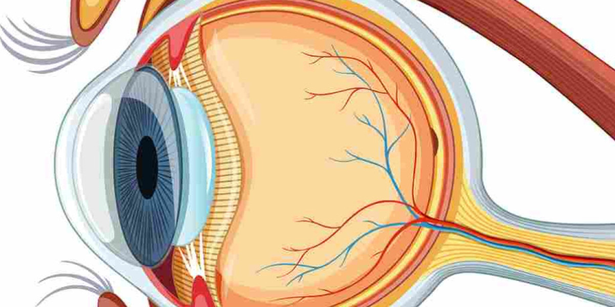 Best Microincision Cataract Surgery in Dubai by Dr. Vasu Kumar