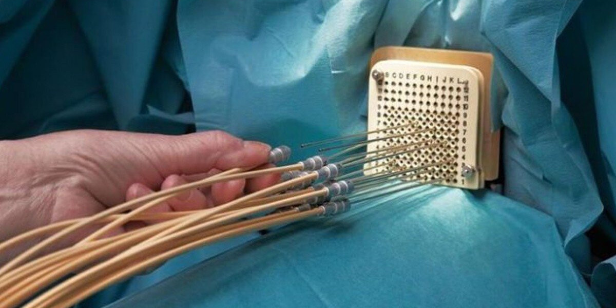 Brachytherapy Devices Market Players Density: Understanding Its Impact on Business Dynamics