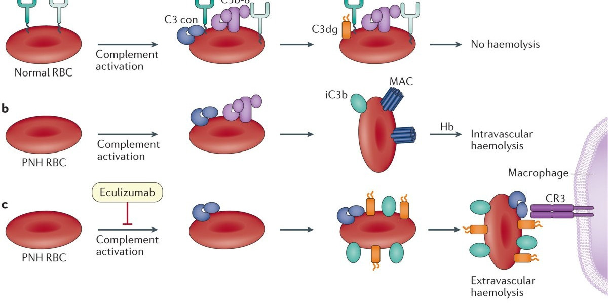 Paroxysmal Nocturnal Hemoglobinuria Market Report Analysis, Share, Trends, Demand 2024-34
