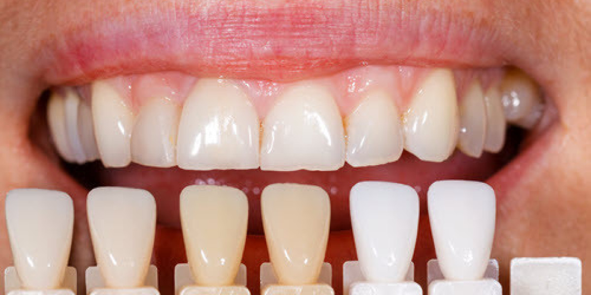How to Choose the Right Emergency Dental Services for Your Needs