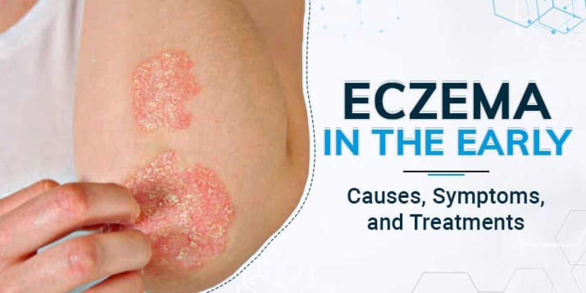 Eczema Market Share, Industry Trends, Forecast 2024-34