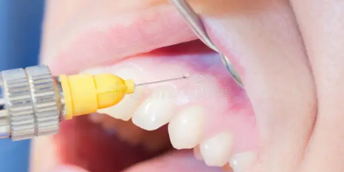 Dental Anesthetics Market: Winning Strategies for Innovation and Growth