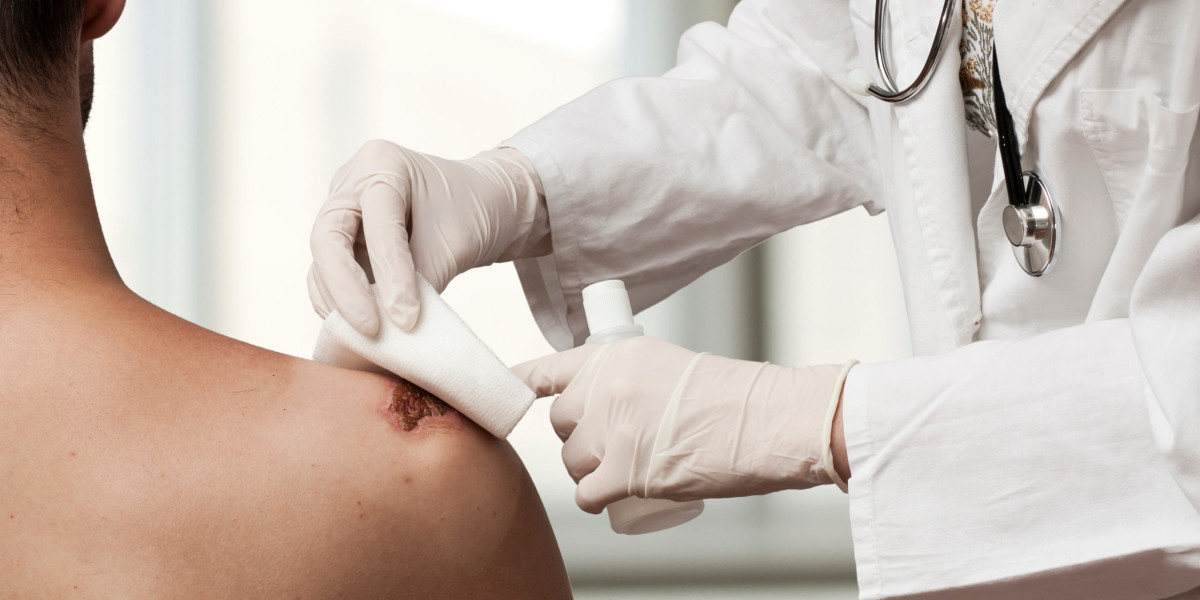 Wound Cleanser Market: Future Outlook for Global Trends and Developments