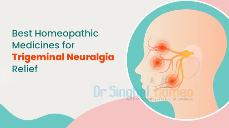 Top 5 Homeopathy Medicine for Trigeminal Neuralgia Relief!