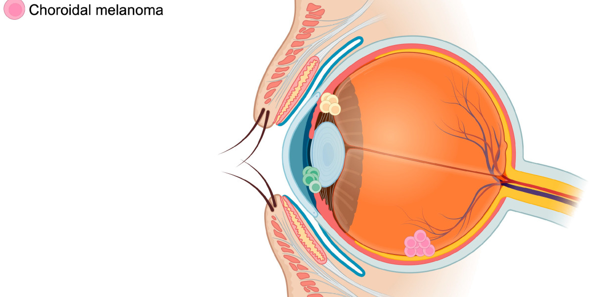 Uveal Melanoma Market Share Analysis, Growth, Report 2024-34