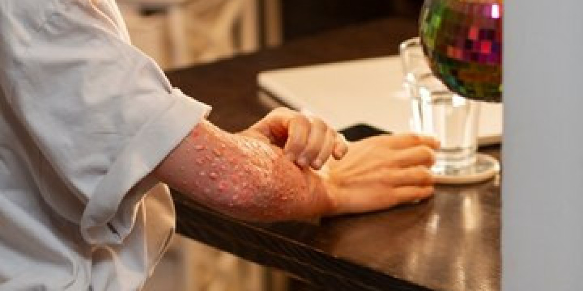 Exploring the Skin Rash Treatment Market:  Size, Share, Insights and Future Forecasts