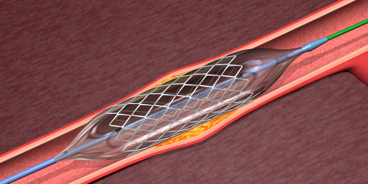 Angioplasty Balloons Market Trends Shaping the Future of Cardiovascular Treatments