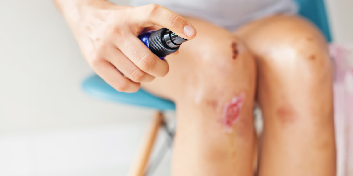 Wound Cleanser Market Boosted by Rising Surgical Procedures and Infection Prevention Awareness