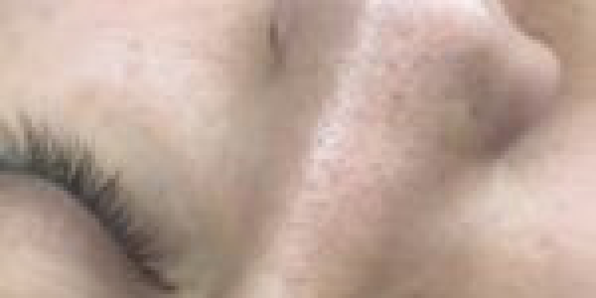 Transform Your Look with Advanced Laser Hair Removal Services