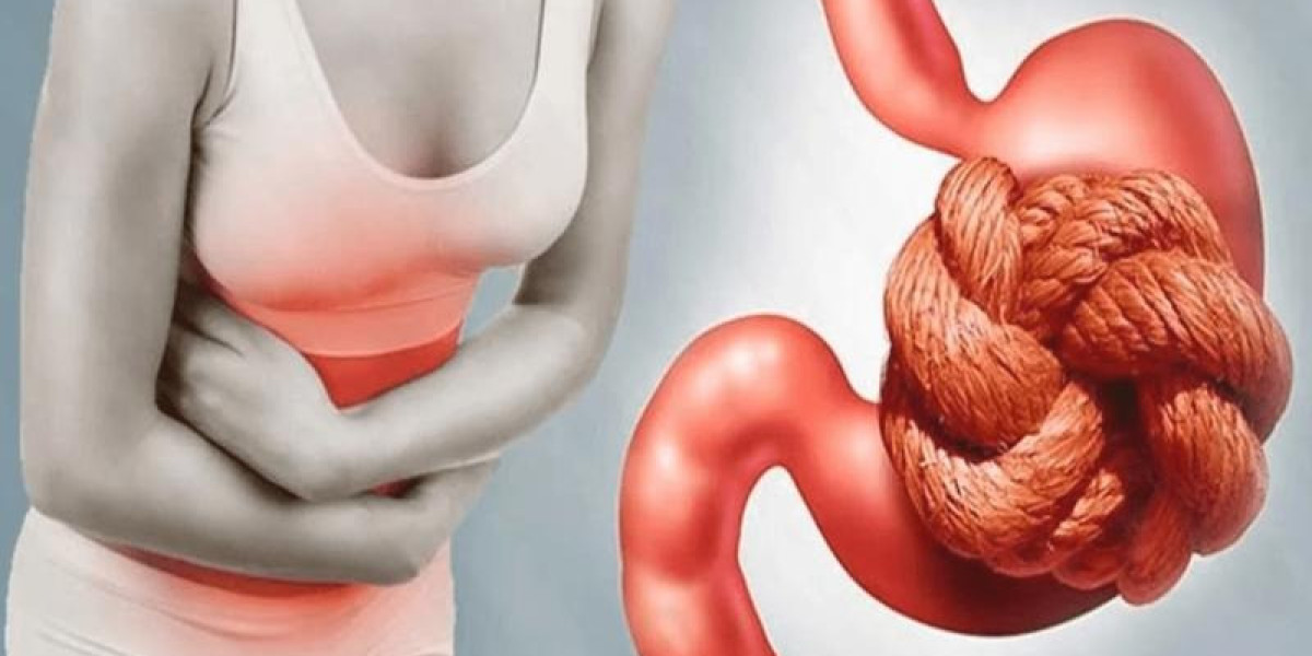 Chronic Idiopathic Constipation Market Share, Industry Size, Trends, Forecast 2024-34