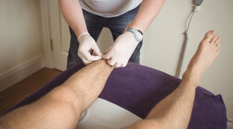 The Benefits of Acupuncture Running Injury in Penn Station for Runners - Free instant approval guest posting Website