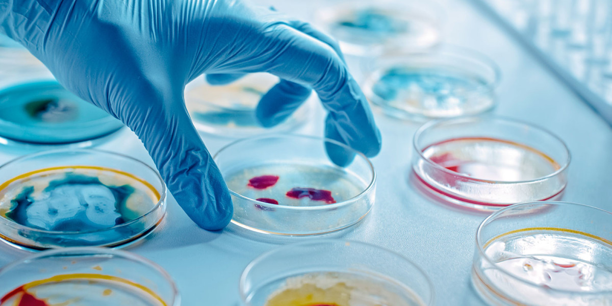 Antimicrobial Susceptibility Test Market Key Future Trends Shaping the Healthcare Landscape