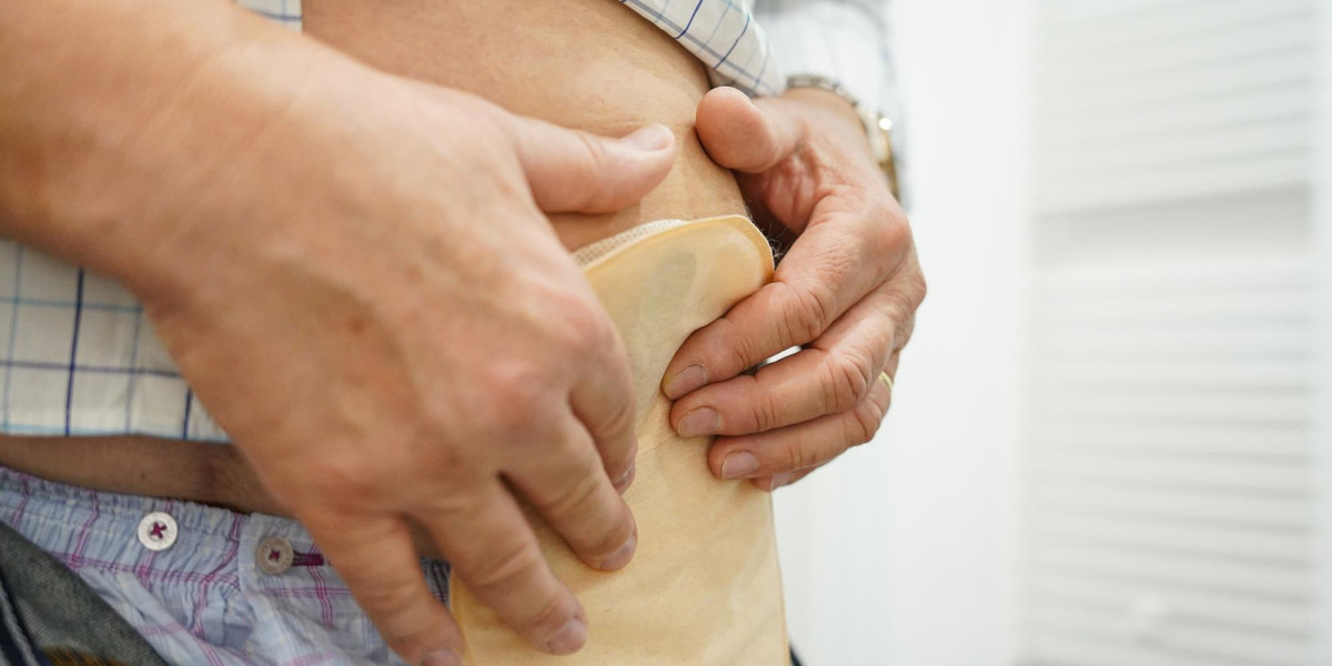 Ostomy Supplies Checklist: What Every Ostomate Needs