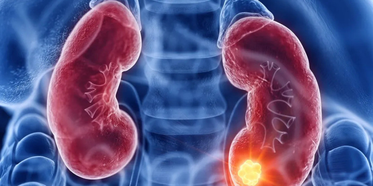 Acute Renal Failure Market Growth & Key Developments in Healthcare 2025