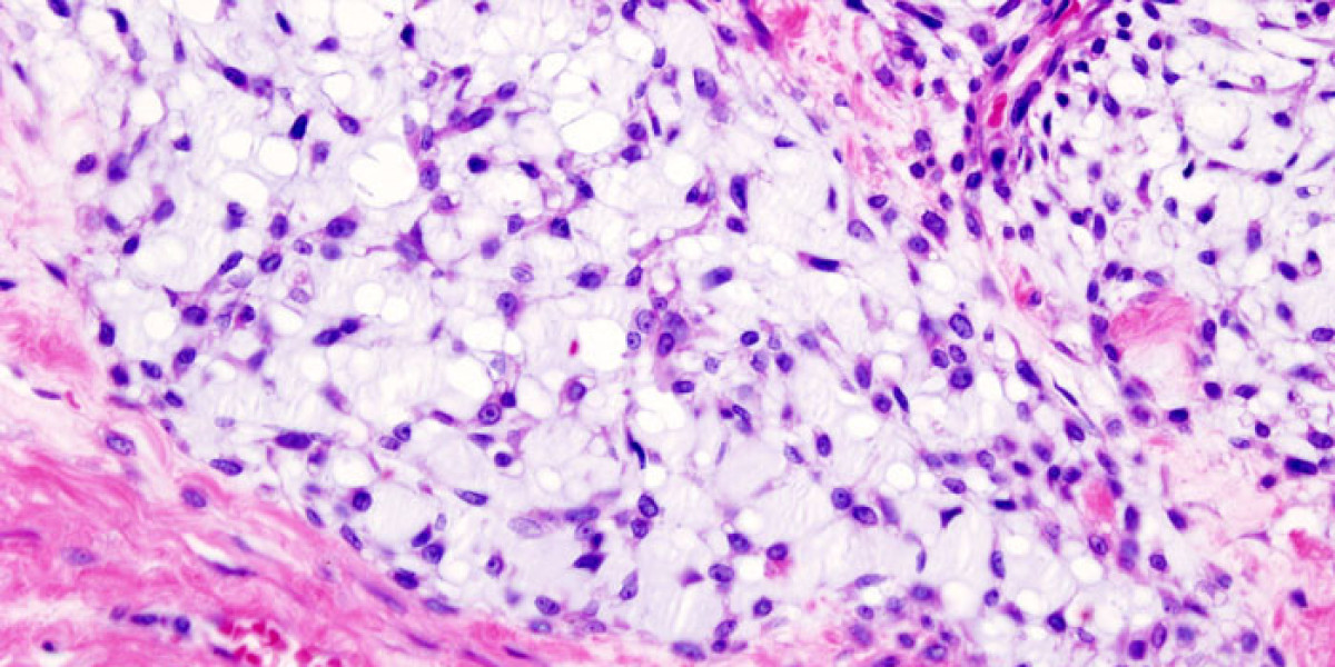 Chondrosarcoma Market Outlook 2024-2031: Top Key Players, Emerging Trends, and Growth Opportunities - Pfizer Inc., Eli L