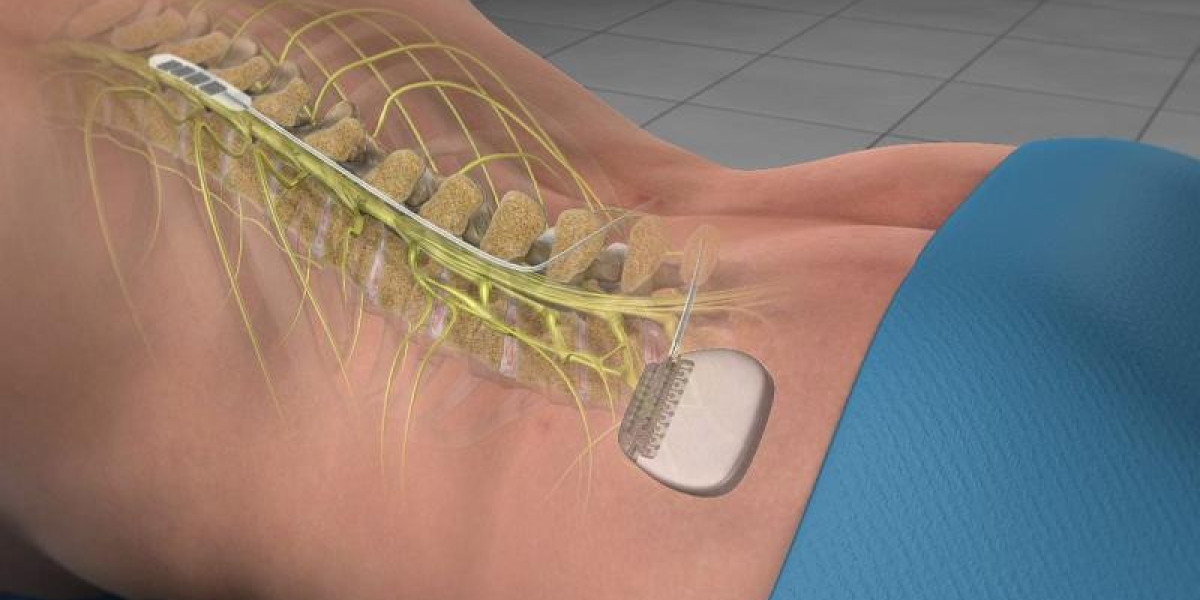 Spinal Cord Stimulation Market Report | Industry Statistics & Demand 2024-2031