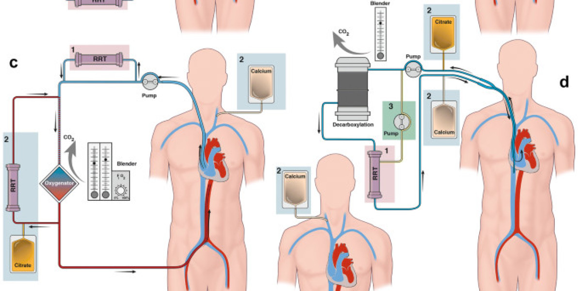 Integrated Organ Support Therapies Market Size, Share & Competitive Analysis