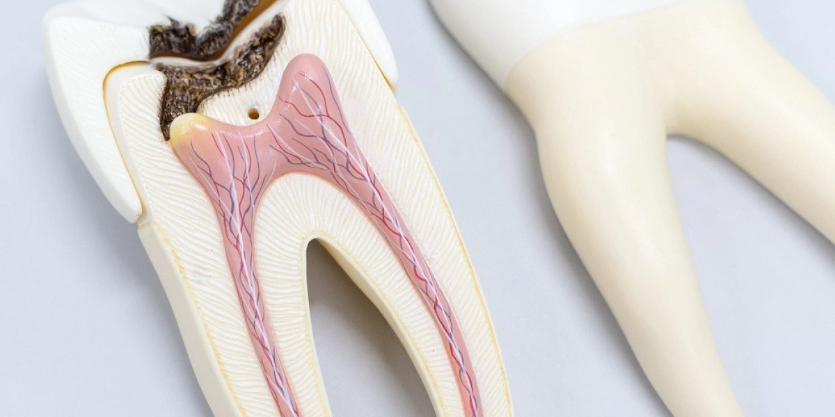 What is the protocol after a root canal?