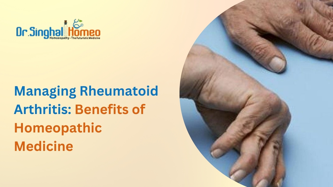 Homeopathy for Rheumatoid Arthritis: A Comprehensive Guide – health