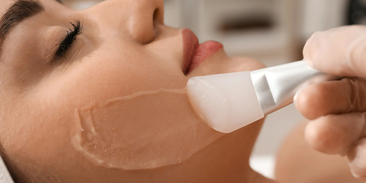 What is an example of a deep peel?