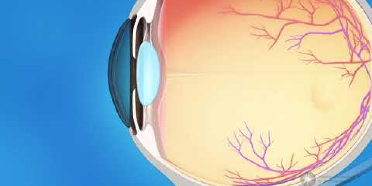 Cost-Effectiveness of Glaucoma Diagnostics Market in Healthcare