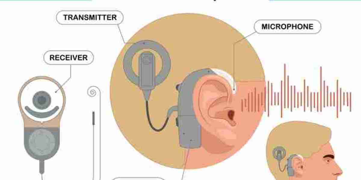 Cochlear Implants Market Size Expansion to Drive Significant Revenues in the Future