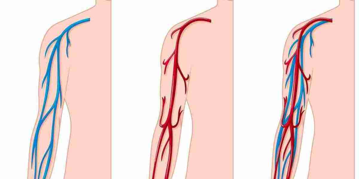 Exploring the Global Vascular Patches Market: Innovations & Insights