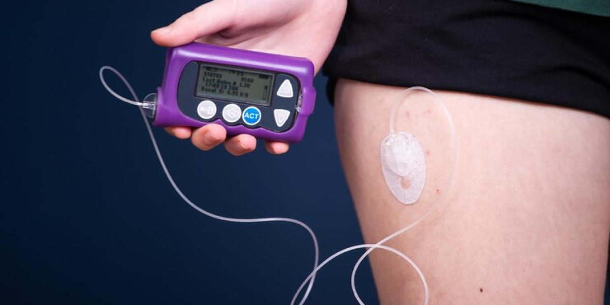 Insulin Infusion Pumps Market: Trends, Growth, and Future Outlook