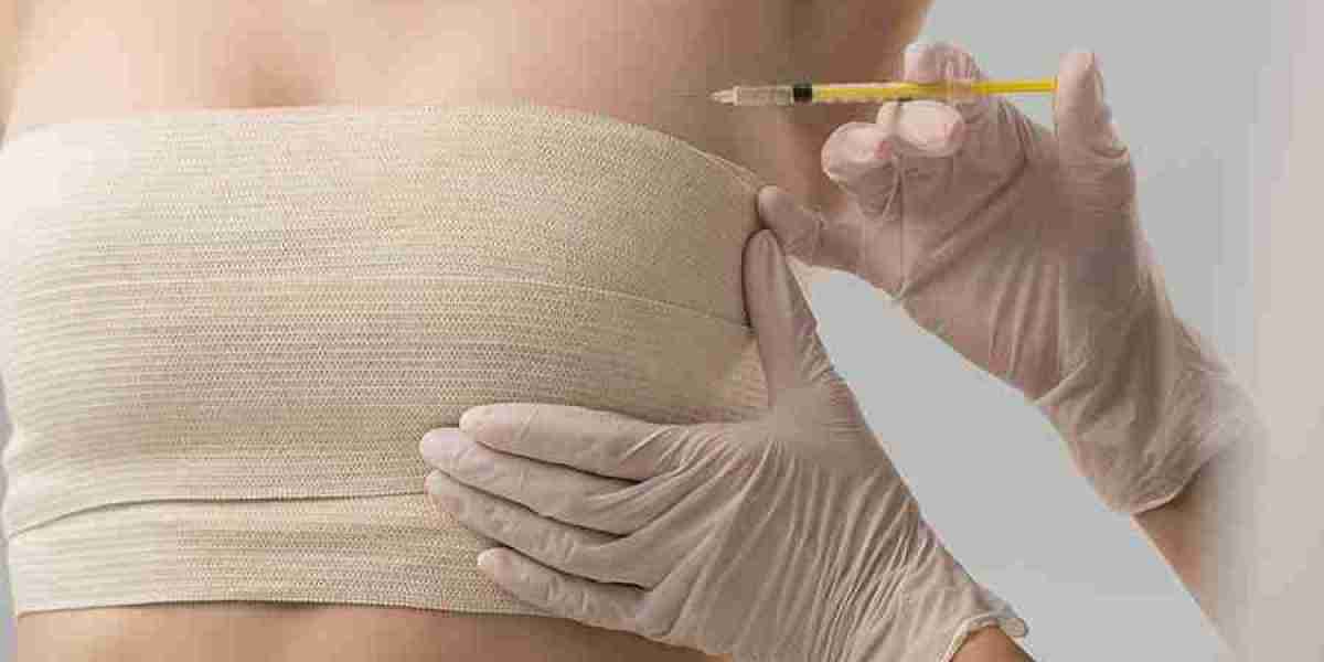 What is the Maximum Fat Transfer to the Breast?