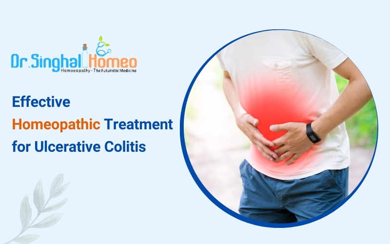 Ulcerative Colitis Treatment and Cure in Homeopathy