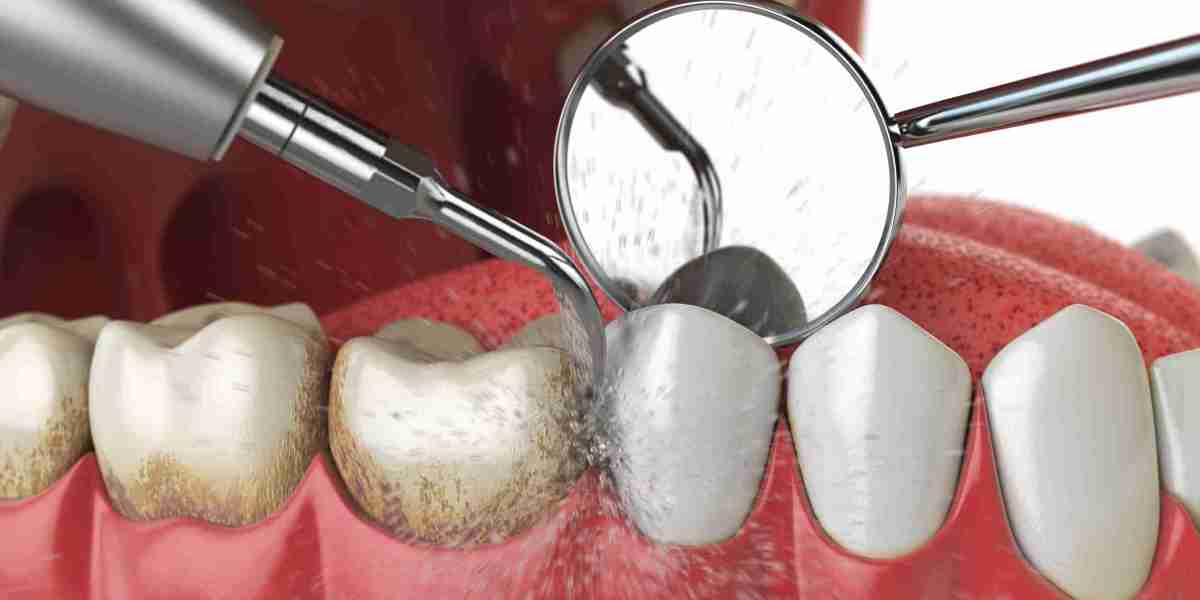 Can I get a regular cleaning instead of a deep cleaning?