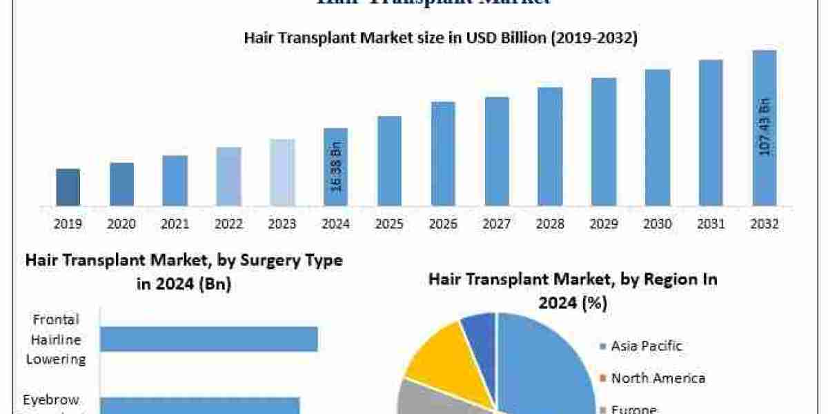 Hair Transplant Market Growth Driven by Male Pattern Baldness and Increasing Social Media Influence