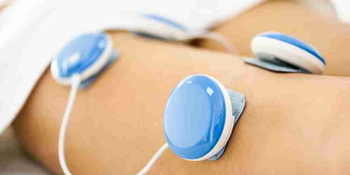 Electrical Stimulators Market Trends 2025: Innovations Driving Growth