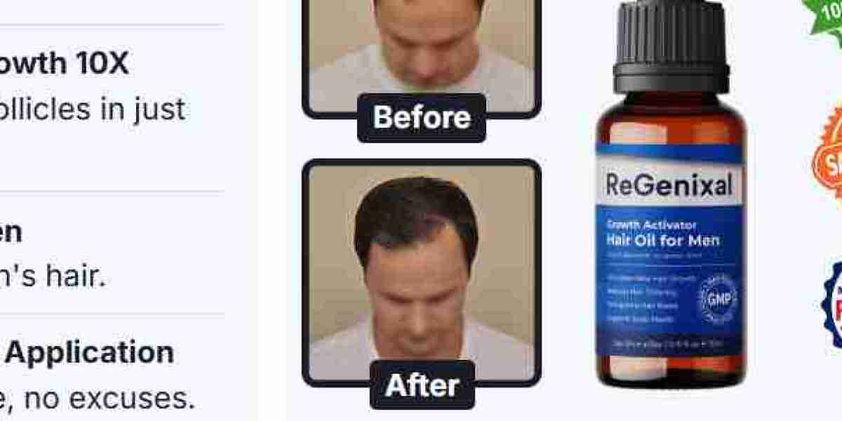 https://www.facebook.com/ReGenixalHairRecoverNewZealandReviews/