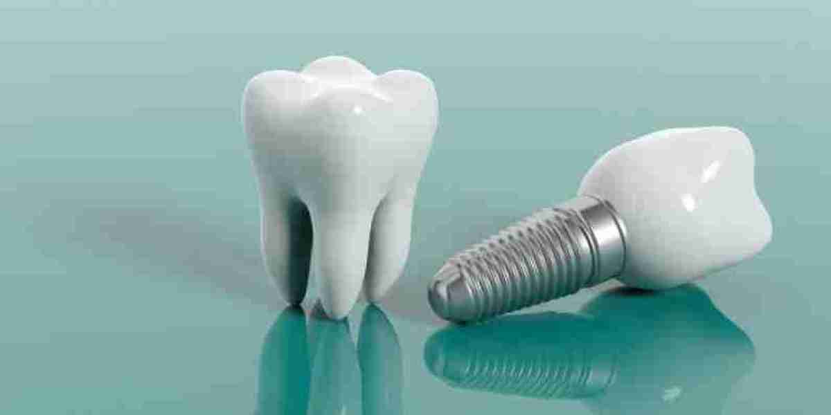 What is a fun fact about dental implants?
